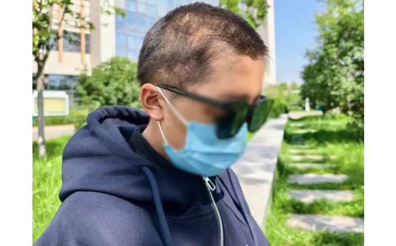 Хятад: Баавгайн дайралтад өртсөн жирэмсэн бүсгүй хэрхэн амьд гарав?