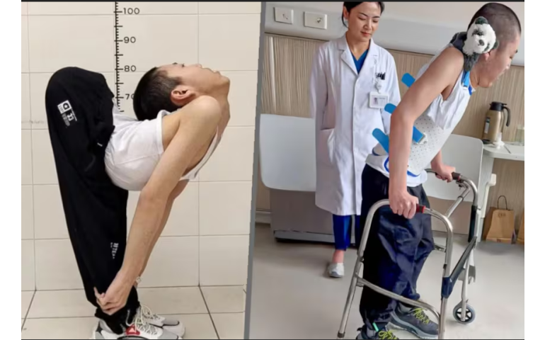 Хятад эмч нар төрөлхийн муруй нурууг тэгшлэх мэс заслыг анх удаа амжилттай хийлээ